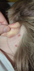 *PHOTO WARNING*Do these look like normal chicken pox?