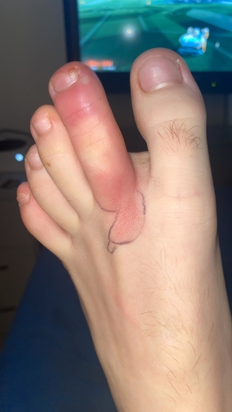 Does this need antibiotics? Pic included