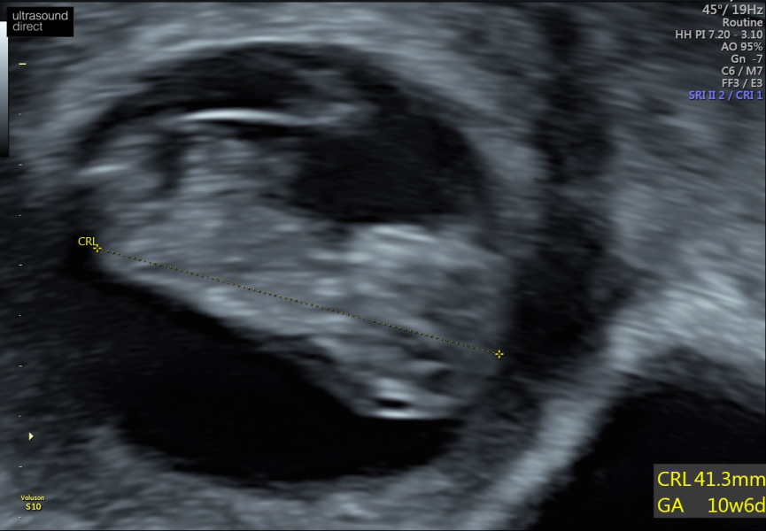 Boy or girl thoughts?