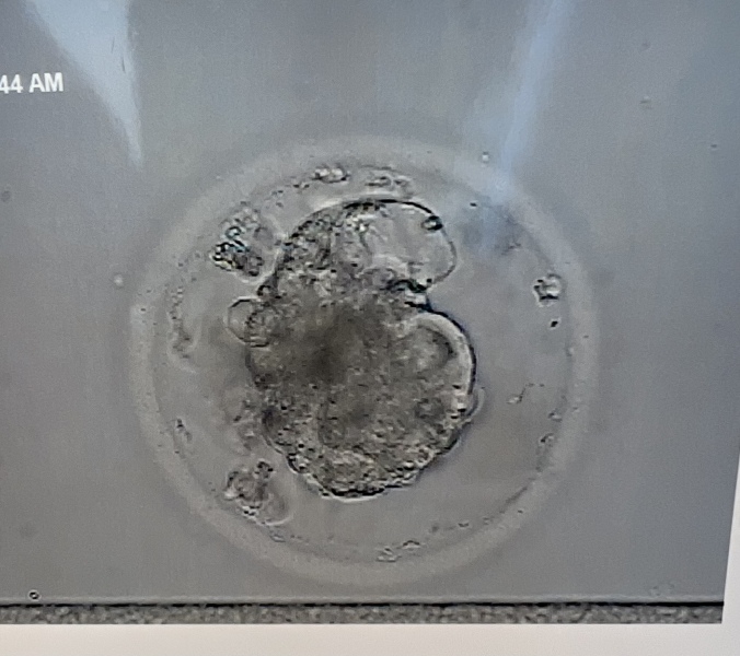 Embryo quality 