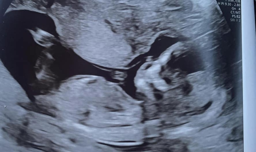 Boy or girl?
