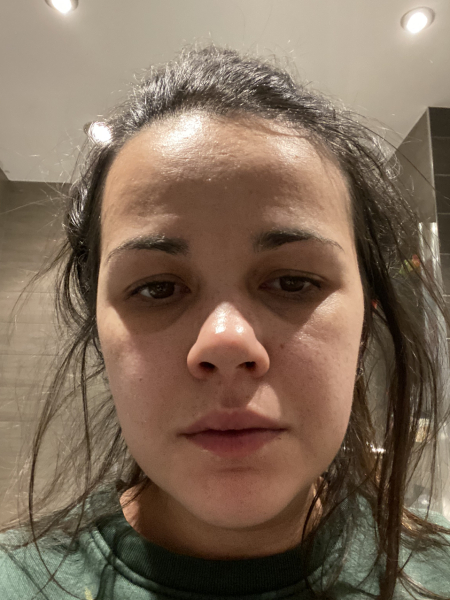Just came over head to toe in a rash
