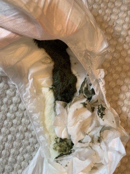 Poo - is this normal? Picture warning 