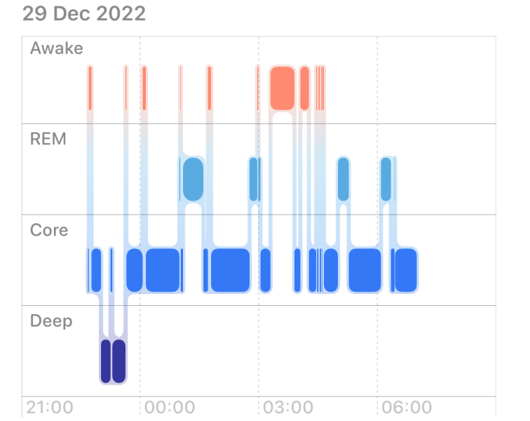 2 year sleep regression?