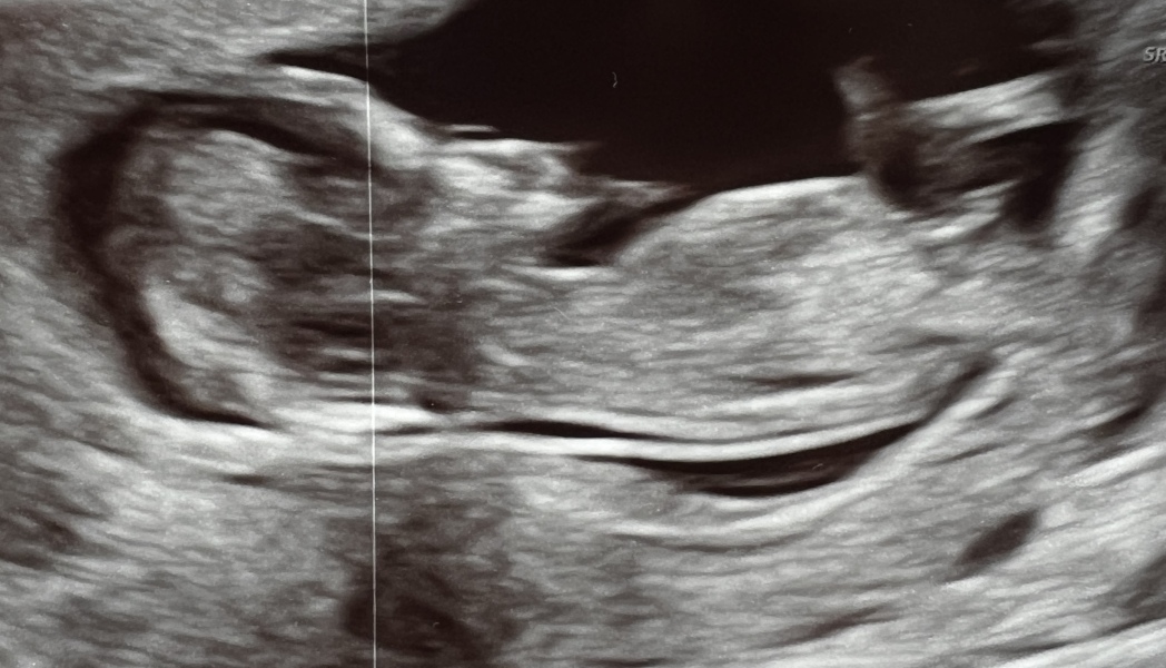 12 week guesses?!