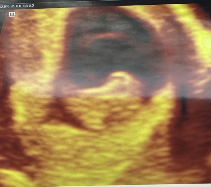 9 week scan photos 📸 