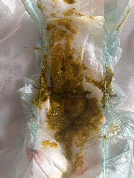 Allergy poo or teething poo or just normal weaning poo