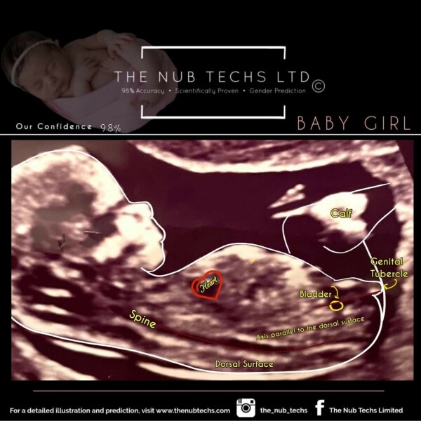 Due December 2022 - the home stretch! (thread 5)