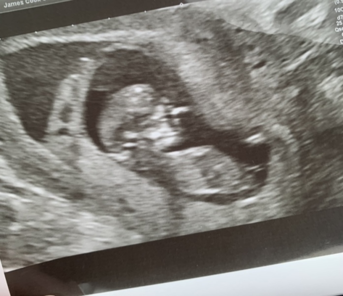 Help need some major reassurance if possible 
