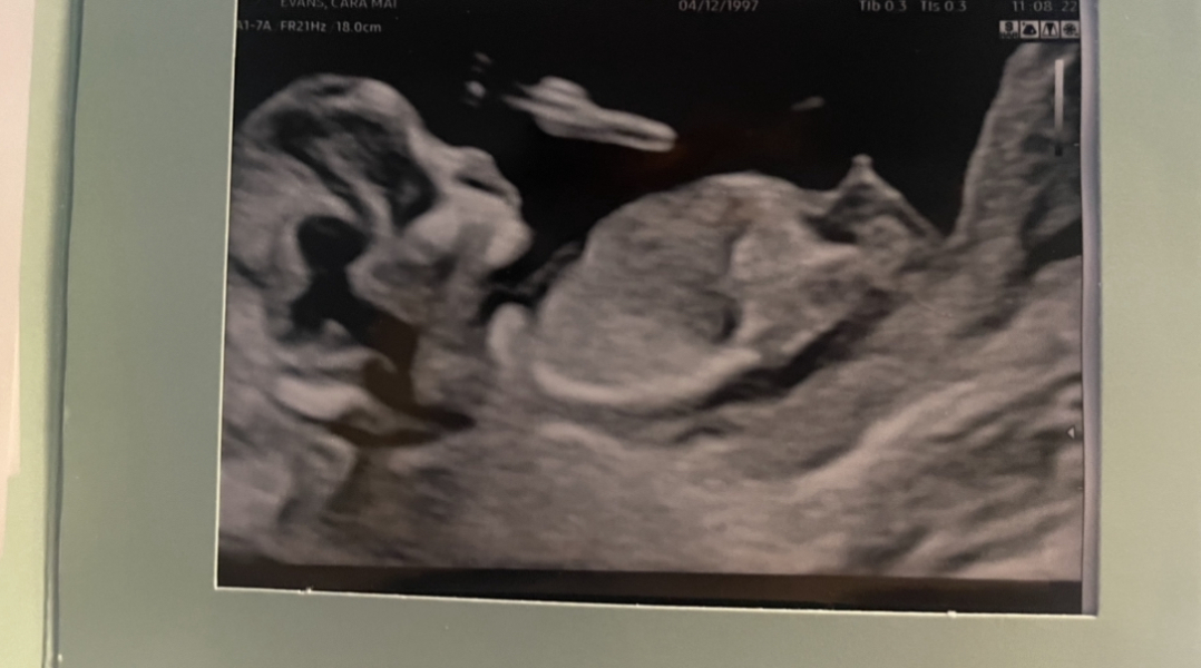Nub - boy or girl guesses?