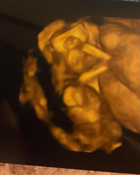June 2023 Babies ☀️ (Thread 3) 