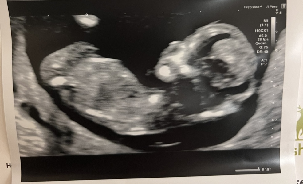 Any guesses on my little one please x