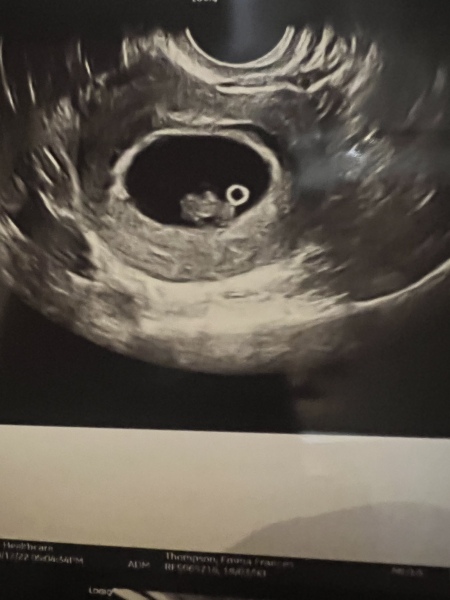 Due August 2023 (Thread 3)