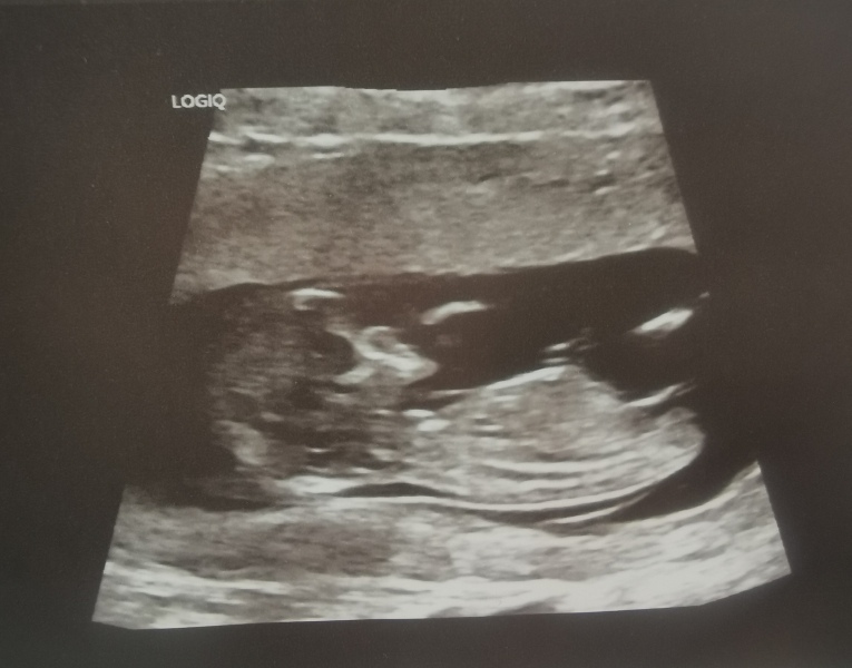 June 2023 Babies ☀️ (Thread 3) 