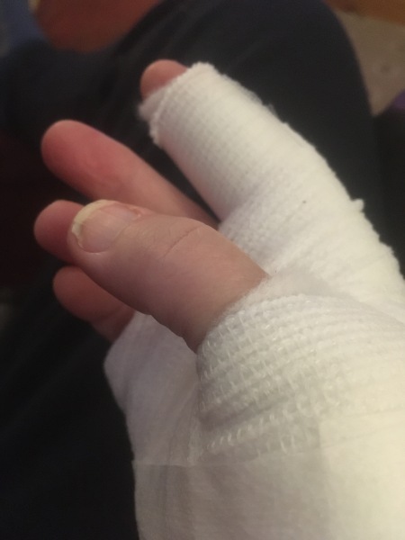 What can I put on my sore finger?