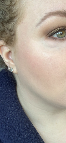 Skincare geeks who don't use tretinoin - why not?