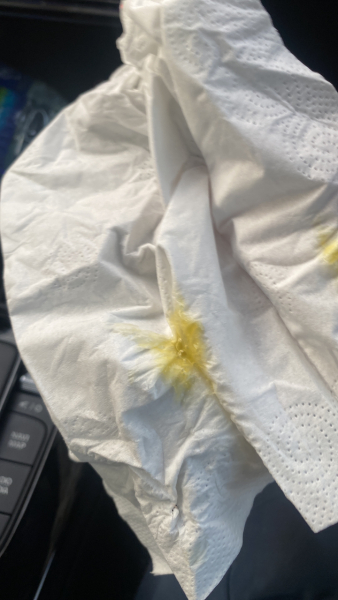 Could this be actual flu and not just a bad cold?