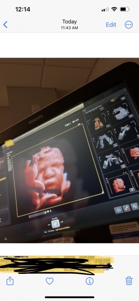 Baby 3D Scan … 