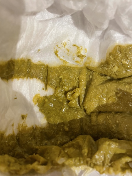 Is this normal baby poo? (Warning poo pictures!) 