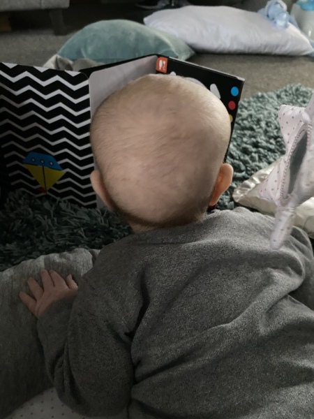 Does this look like Crainosynotosis?? Help!