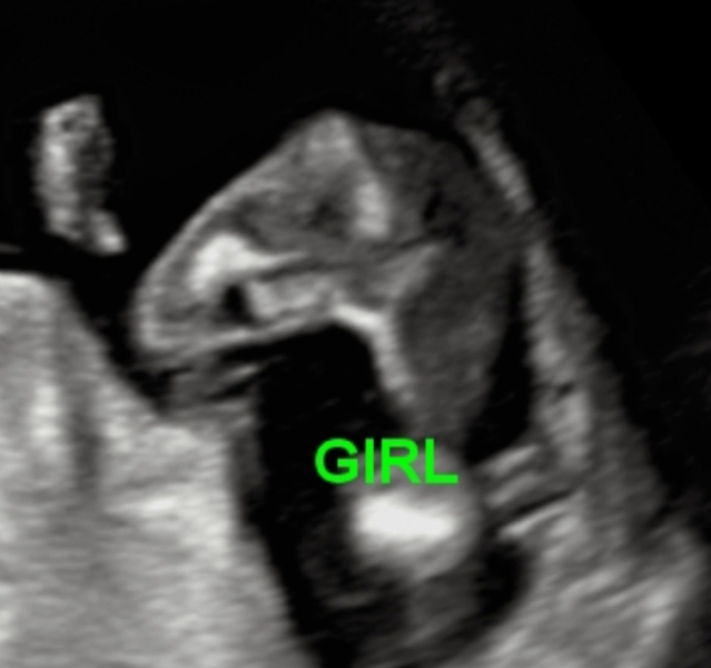 Just for fun but any boy/girl guesses!