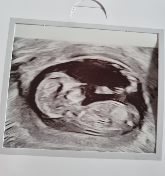 June 2023 Babies ☀️ (Thread 3) 