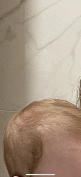 newborn hair turning orange?