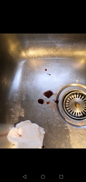 Sinus rinse