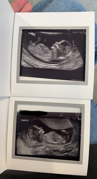 Any nub guesses for my twins please ! X