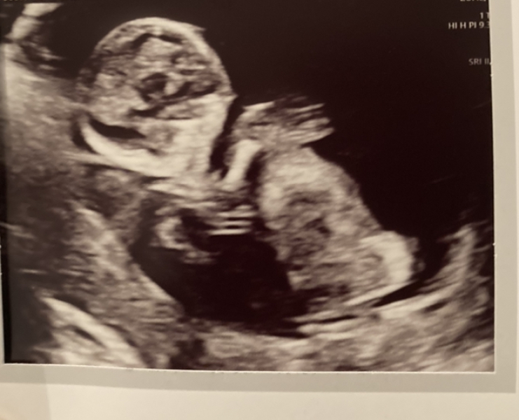 Ultrasound help 