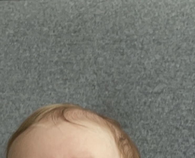 newborn hair turning orange?