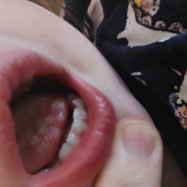 Drs don't what this is. Can you help?? 