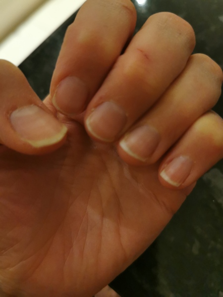 Nails