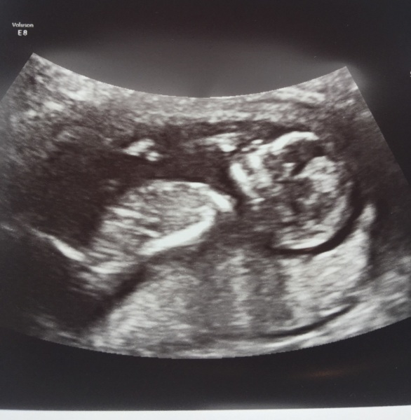 Boy or girl?