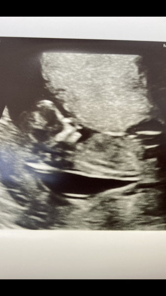 Just for fun but any boy/girl guesses!