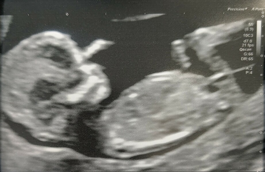 Gender Guesses? (I have no idea how these theories work!)