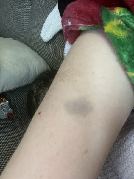 abuse advice 