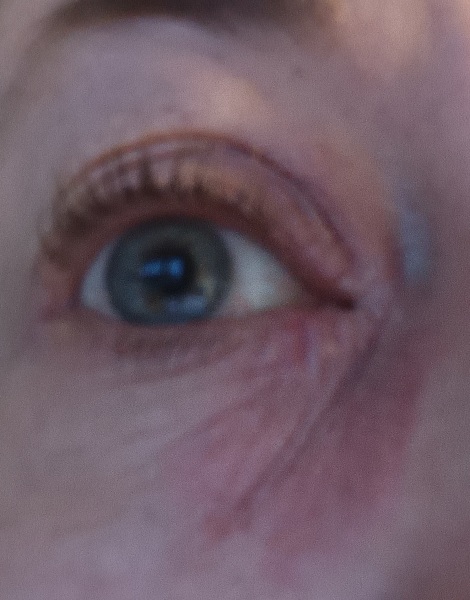Any dermatologists or GPs who can advise? Desperate! 