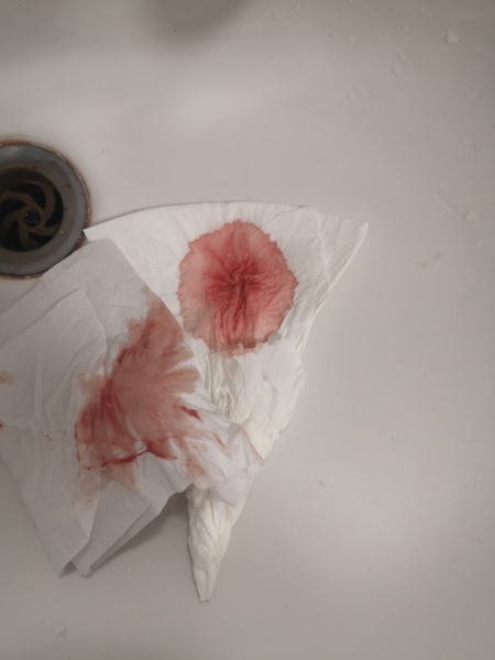 *Warning - Graphic image* Positive test (IC and FR) but watery bleeding for nearly a week