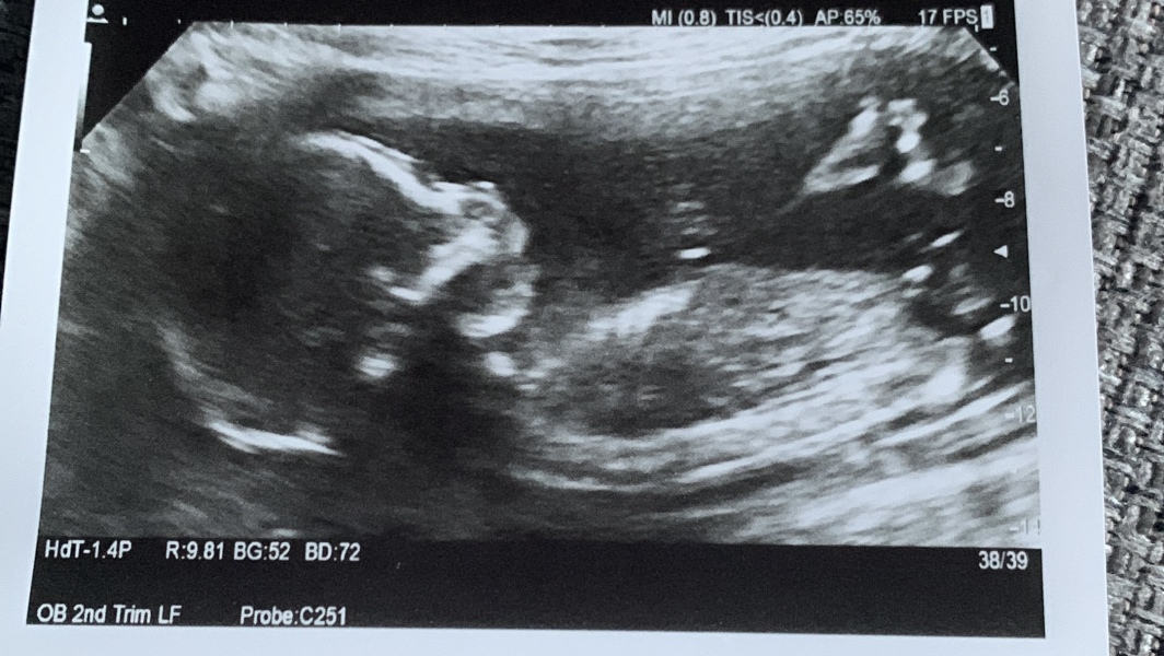 Due March 2023 - thread 5