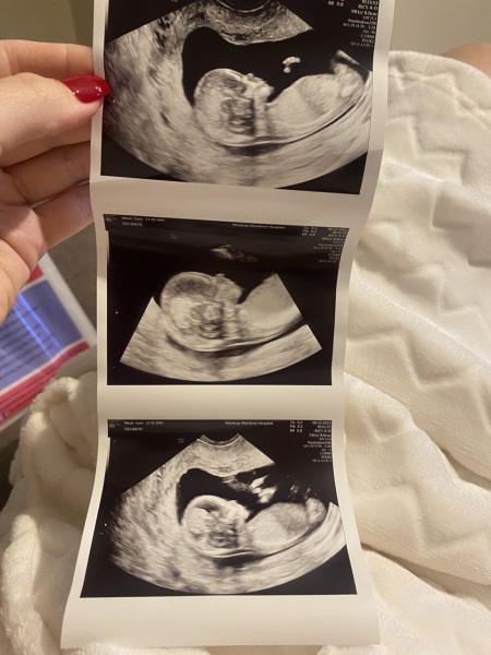 Boy or girl !