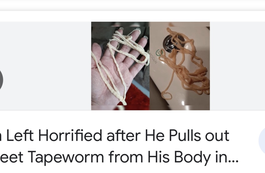 What is this? DH has worms - gross pic, sorry 
