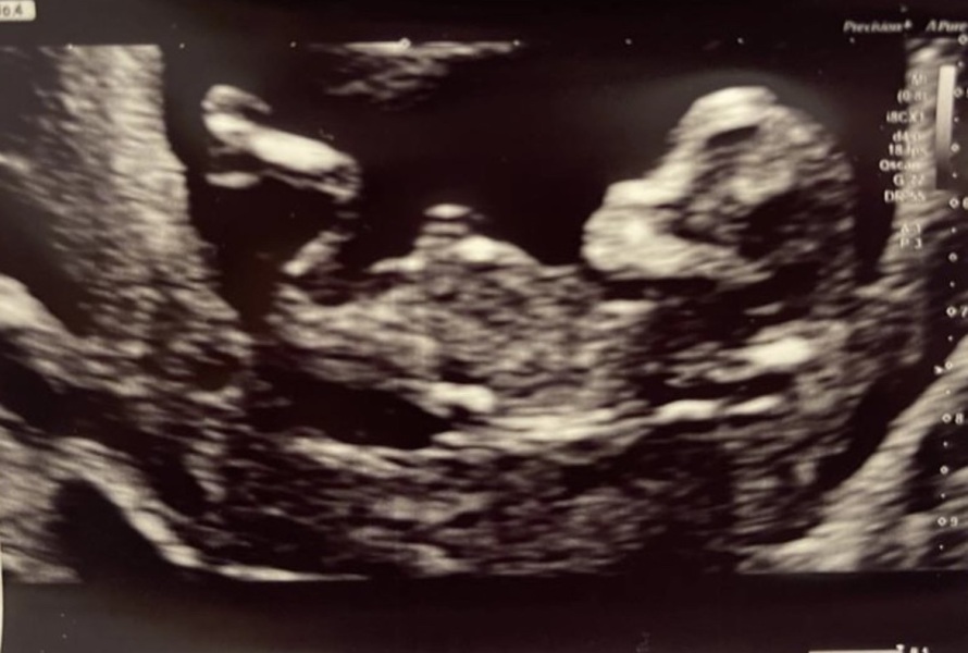 Gender guesses- nub theory