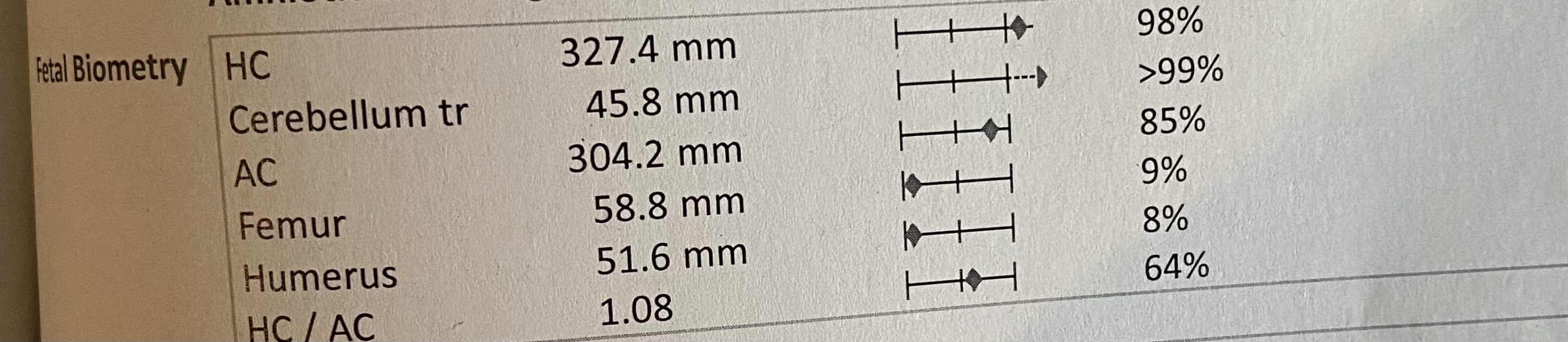 Head circ at 98th centile @ 7 wks - anyone else?