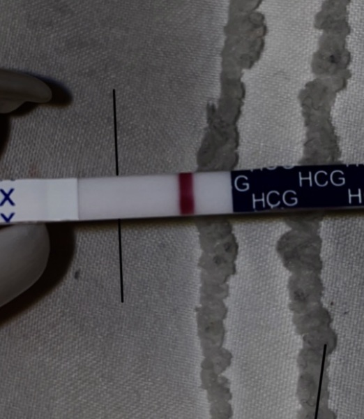 11DPO