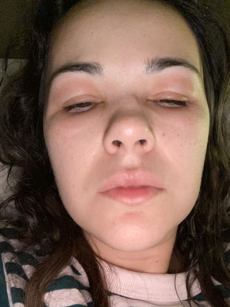 Just came over head to toe in a rash