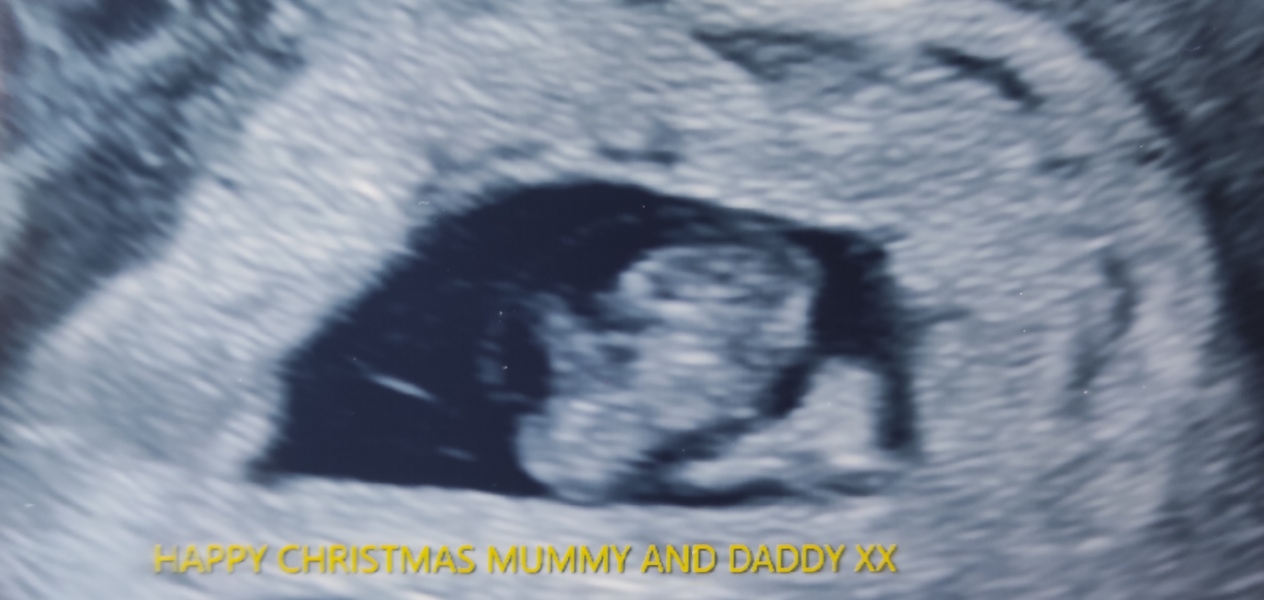 Due August 2023 (Thread 3)