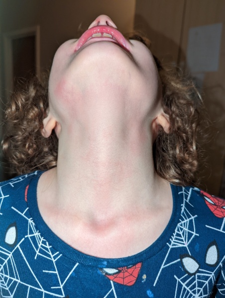 Help needed identifying a rash on my child 