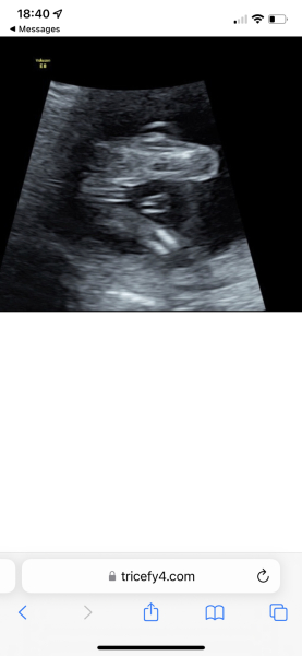 Potty shot... is this a boy or girl? See 5 photos!