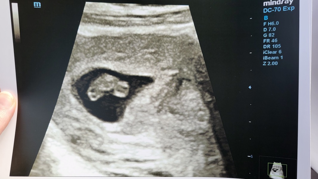 Due July 2023